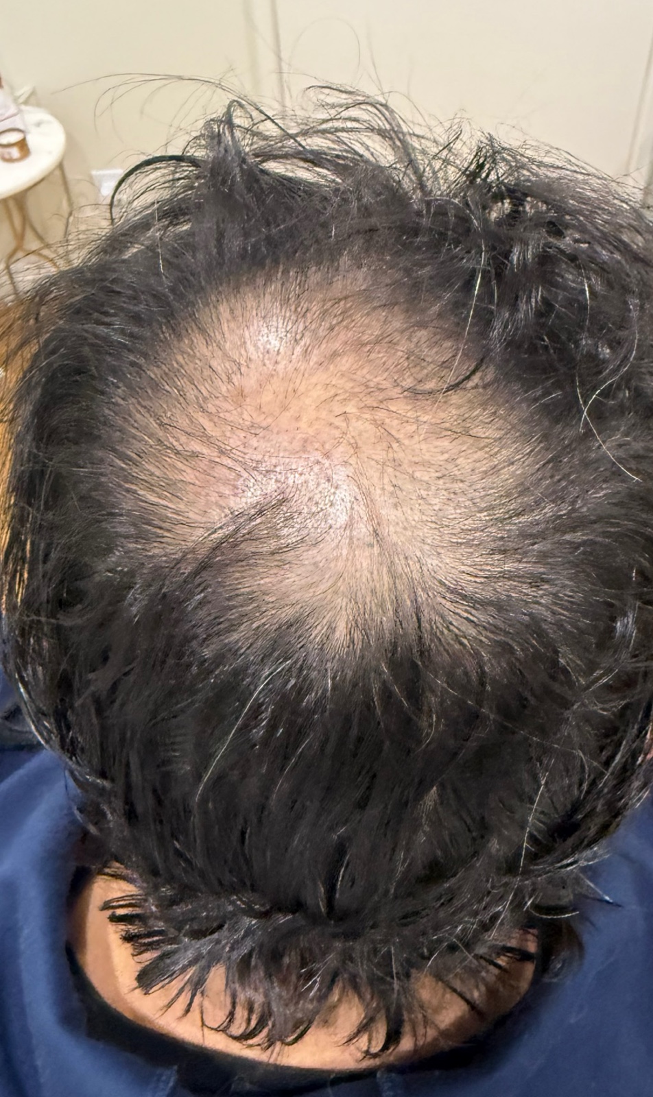 Hair comparison: before